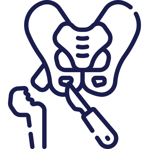 Conocidas también como "rodilla del corredor" produce dolor en la parte delantera de la rodilla y alrededor de la rotula